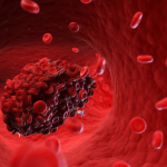 7 Foods to Prevent a Deadly Blood Clot