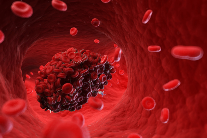7 Foods to Prevent a Deadly Blood Clot